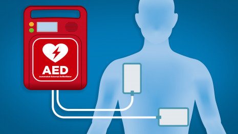 醫用護理床：黃金搶救4分鐘，使用CPR，AED指南！