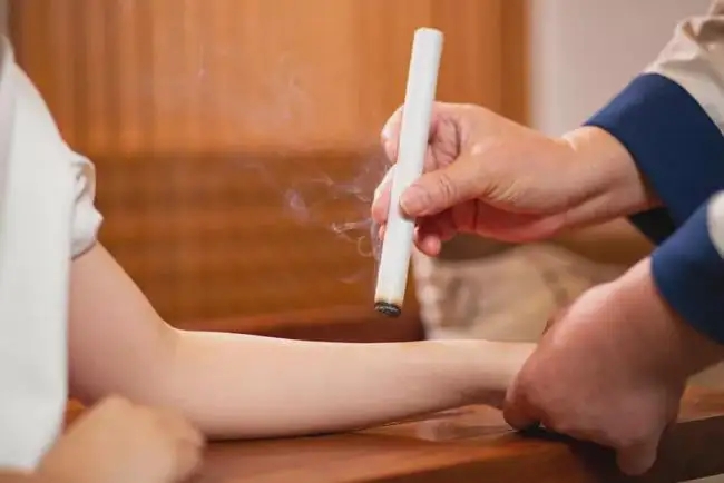 艾灸和拔罐的注意事項！